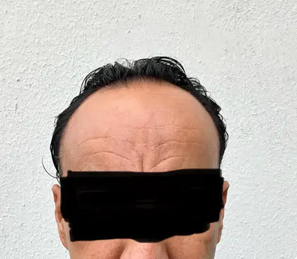 UnitedCare Hair Transplant Clinic