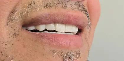 U Smile Dental Clinic