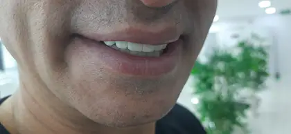 U Smile Dental Clinic