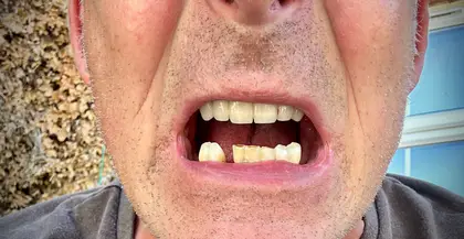 Global Dental Center Global Dental Center