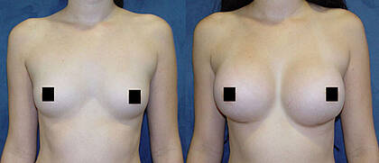 Dr. Rodrigo Araya Plastic Reconstructive Surgery clinic