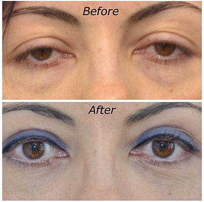 Dr. Rodrigo Araya Plastic Reconstructive Surgery clinic