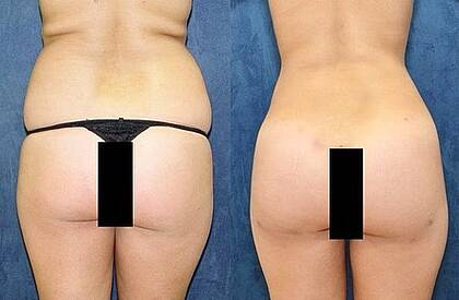 Dr. Rodrigo Araya Plastic Reconstructive Surgery clinic